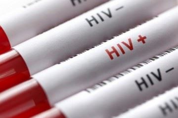 تعداد مردان مبتلا به HIV در ایران بیشتر است