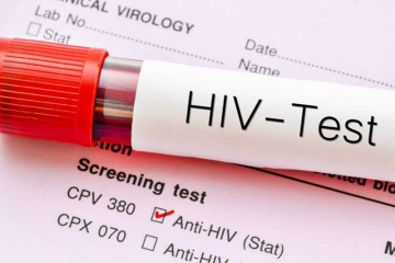 نباید اجازه دهیم که کووید ۱۹ برنامه HIV را تحت تاثیر قرار دهد