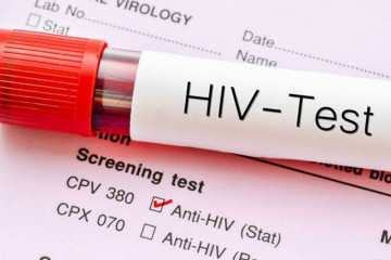 HIV چگونه منتقل می‌شود و راه‌های پیشگیری از آن چیست؟