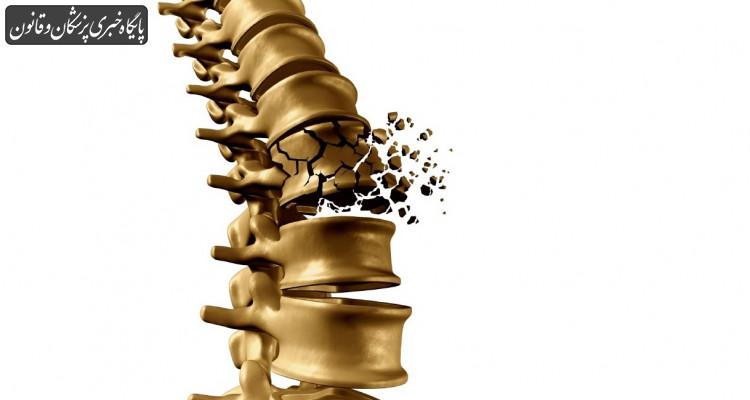 پوکی استخوان یک بیماری خاموش به ویژه در سالمندان