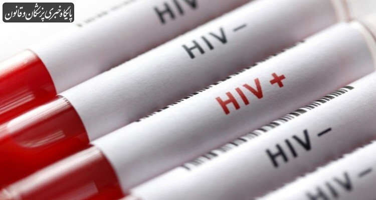 اهمیت تشخیص زودرس HIV جهت درمان و پیشگیری از ورود به مرحله ایدز