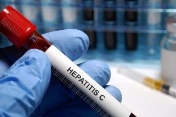 حذف هپاتیت C در بیماران هموفیلی، دیالیزی و تالاسمی در کشور