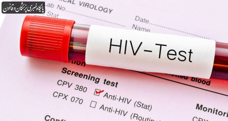 HIV یک بیماری عفونی قابل کنترل است