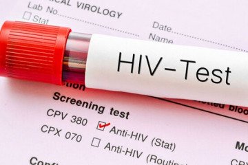 HIV یک بیماری عفونی قابل کنترل است