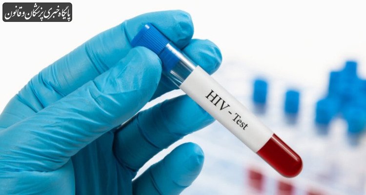 تست HIV در مراکز دولتی کاملاً رایگان و محرمانه است