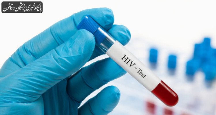 الگوی انتقال ویروس HIV تغییر کرده است