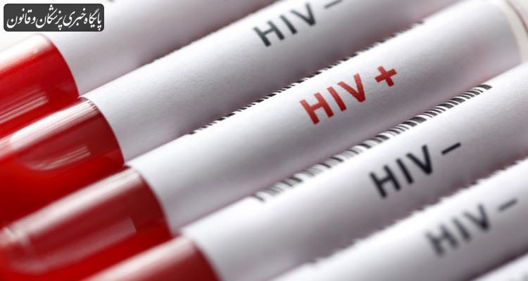 استفاده از تکنولوژی اصلاح ژنی به منظور پاک کردن ویروس HIV از DNA