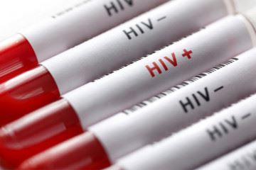 استفاده از تکنولوژی اصلاح ژنی به منظور پاک کردن ویروس HIV از DNA